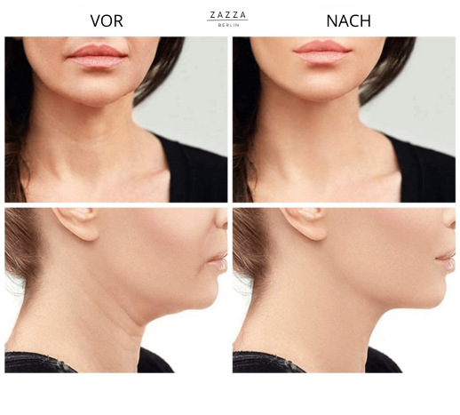 ZAZZA Glowy  | Verbessern Sie Ihre Haut!